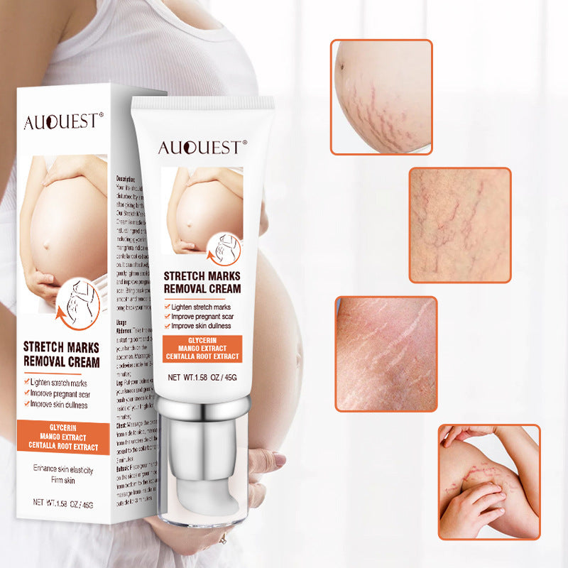 Remove Pregnancy Scars Acne Cream Stretch Mark Treatment Maternity Repair Anti-Aging Anti-Winkle Firming Body Cream