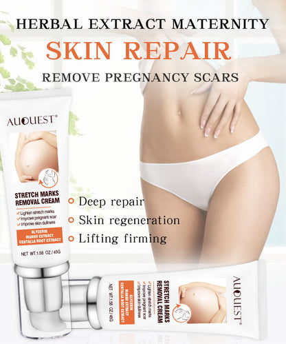 Remove Pregnancy Scars Acne Cream Stretch Mark Treatment Maternity Repair Anti-Aging Anti-Winkle Firming Body Cream