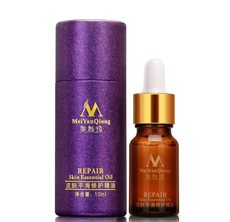 Scar Skin Repair Essential Oil Lavender Care Natural Skin Pure Remove Ance Burn Strentch Marks Removal Scar 10 ML - Peakshop