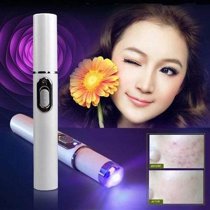 Blue Light Therapy Acne Laser Pen Soft Scar Wrinkle Removal Treatment Device Skin Care Beauty Equipment - Peakshop