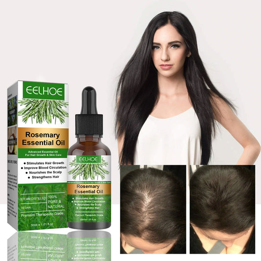 Rosemary Anti-Breakage Nourishing Hair Care Oil - Peakshop