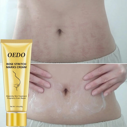 Rose Stretch Mark Removal Cream Anti-Aging