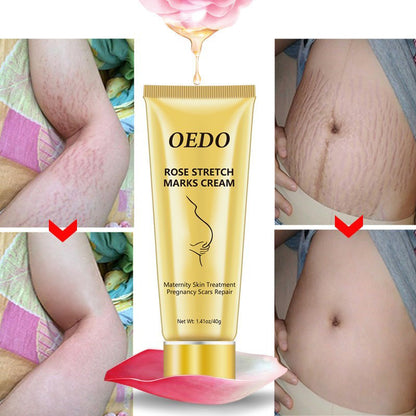 Rose Stretch Mark Removal Cream Anti-Aging