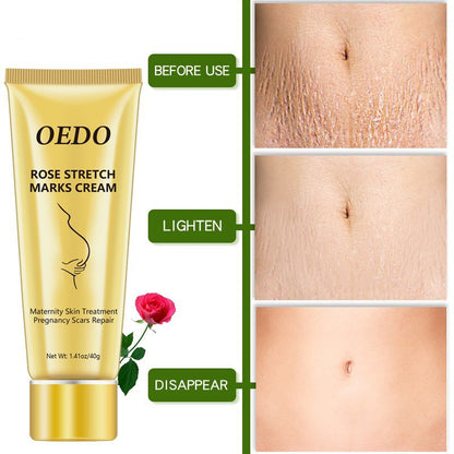 Rose Stretch Mark Removal Cream Anti-Aging