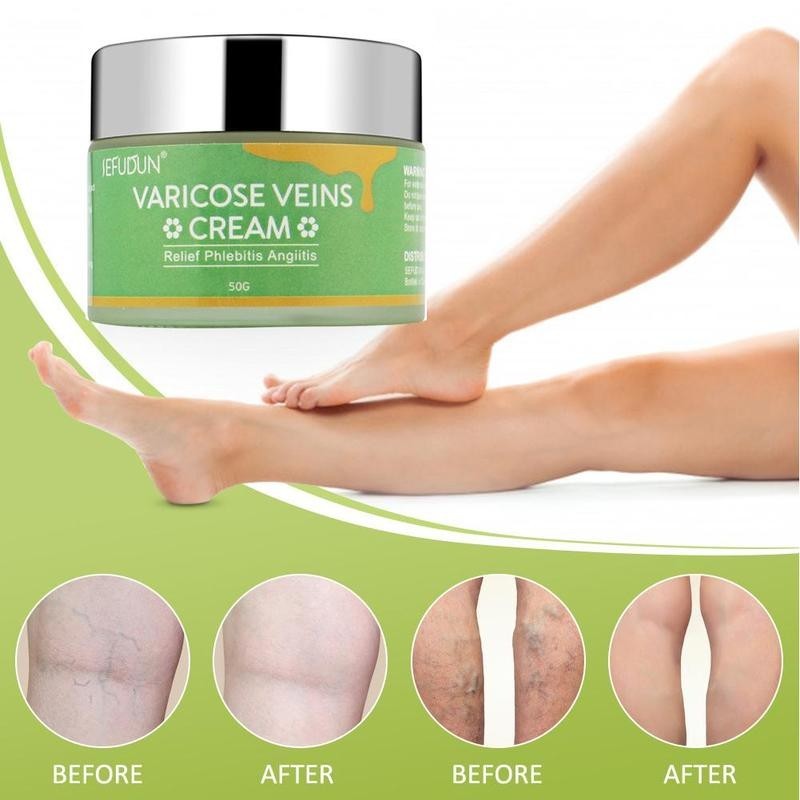 Crème contre les veines Réparation des traces de sang rouge Ver de terre Contusions aux jambes Soulagement des renflements Douleur Carthame Lotion de soin de la peau Crème contre les varices